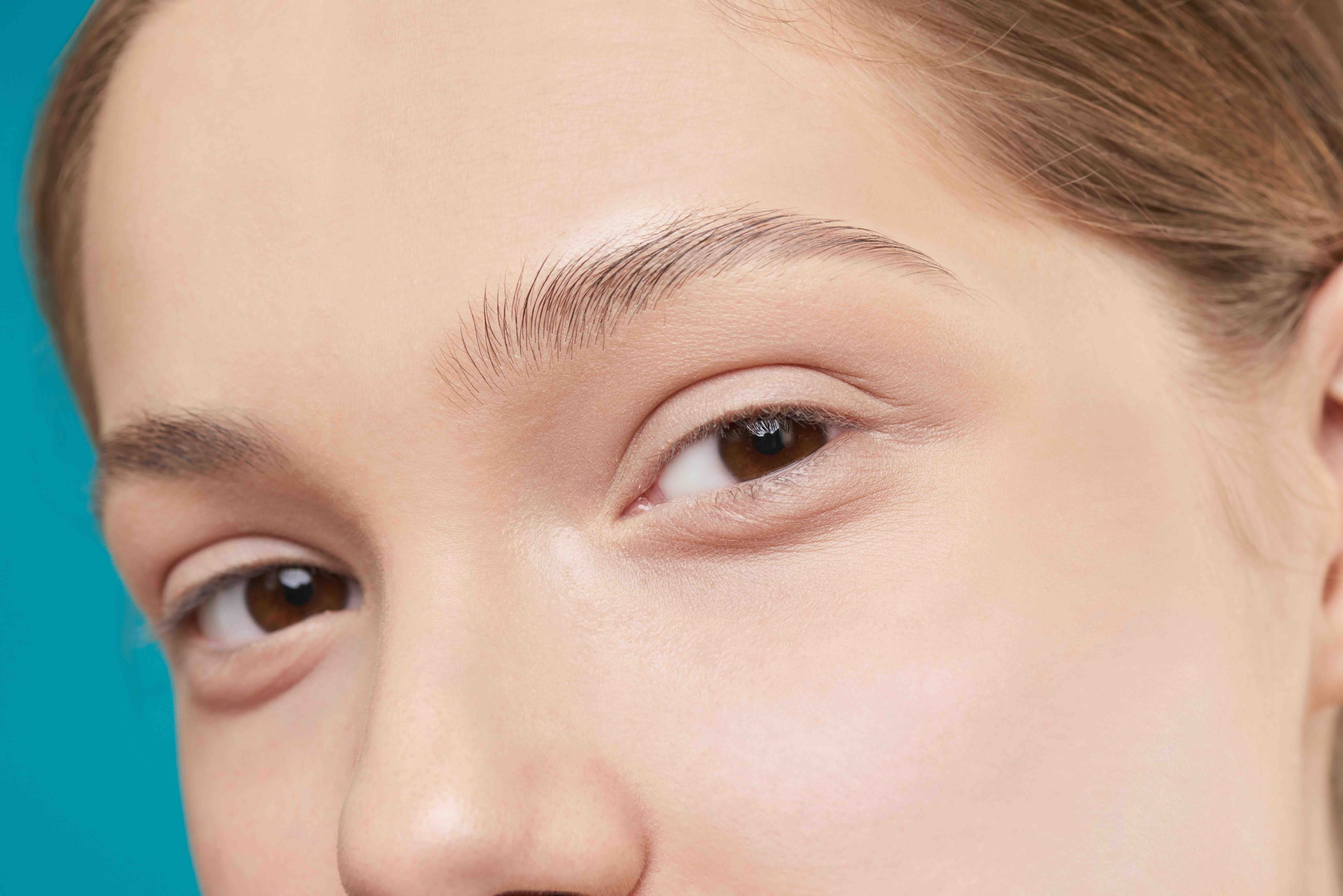 Unlocking Radiance: Korean Expertise in Under-Eye Fat Repositioning and Lower Blepharoplasty