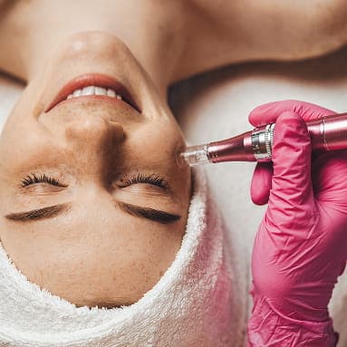 Microneedling
